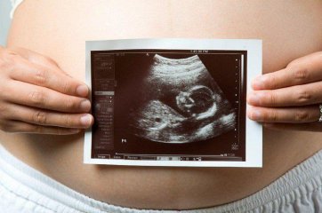 Как протекает беременность при миоме?