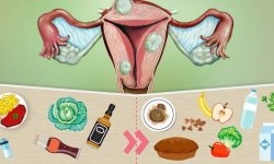 Особенности диеты при миоме матки